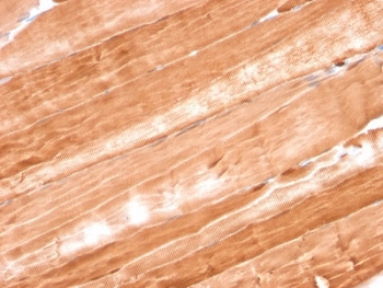 IHC staining of FFPE rat skeletal muscle with Myoglobin antibody (clone MB/2105). HIER: boil tissue sections in pH6, 10mM citrate buffer, for 10-20 min and allow to cool before testing.