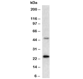 Recombinant Mammaglobin A Antibody MMGA-1R western blot analysis. Western blot testing of human MCF-7 cell lysate using Recombinant Mammaglobin A Antibody (clone MMGA-1R). A band is detected at approximately 10-21 kDa, consistent with the predicted molecular weight range of Mammaglobin A / SCGB2A2 depending on the level of glycosylation. The smaller molecular weight band reflects the core protein, while slightly higher apparent sizes can occur due to post-translational glycosylation or differential processing of this secreted epithelial protein.