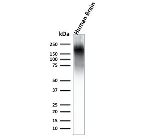 Western blot testing of human brain lysate with recombinant Neurofilament antibody. Expected molecular weight ~200 kDa.