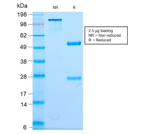 SDS-PAGE analysis of purified, BSA-free recombinant Neurofilament antibody (clone NEFL/2983R) as confirmation of integrity and purity.