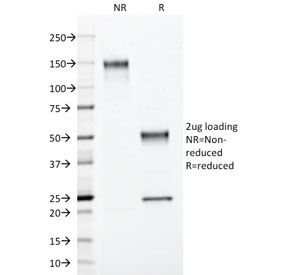 SDS-PAGE analysis of purified, BSA-free Progesterone Receptor antibody (clone PGR/2694) as confirmation of integrity and purity.