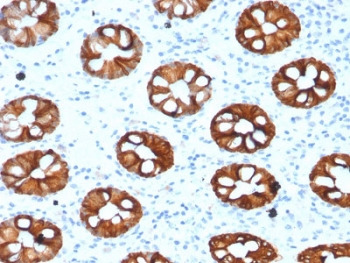 CK20 Antibody for IHC (clone KRT20/1993). Immunohistochemistry analysis of human colon tissue using mouse monoclonal CK20 antibody (clone KRT20/1993). HRP-DAB brown chromogenic staining highlights cytoplasmic Keratin 20 / Cytokeratin 20 (KRT20) expression in epithelial cells lining colonic glandular crypt structures, while surrounding stromal cells remain largely negative. The staining pattern reflects the expected epithelial localization of this intermediate filament protein in gastrointestinal mucosa. Required HIER: boil tissue sections in 10 mM citrate buffer, pH 6, for 10-20 min followed by cooling at RT for 20 min.