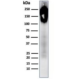 Western blot testing of human spleen lysate with recombinant CD45 antibody.