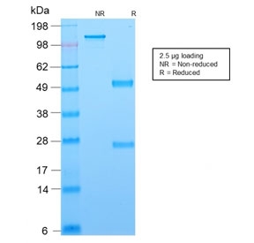 SDS-PAGE analysis of purified, BSA-free recombinant Bcl6 antibody (clone rBCL6/1718) as confirmation of integrity and purity.