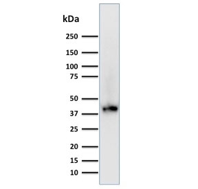 BMI1 Antibody 293T Cell WB. Western blot testing of human 293T lysate with BMI1 antibody (clone BMI1/2689). Expected molecular weight: 37-43 kDa.
