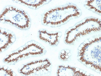 IHC staining of FFPE human small intestine with HNF1A antibody (clone HNF1A/2087). HIER: boil tissue sections in pH6, 10mM citrate buffer, for 10-20 min and allow to cool before testing.