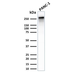 Western blot testing of human PANC-1 and HeLa cell lysate with recombinant Spectrin beta III antibody (clone SPTBN2/2887R). Predicted molecular weight ~246 kDa.