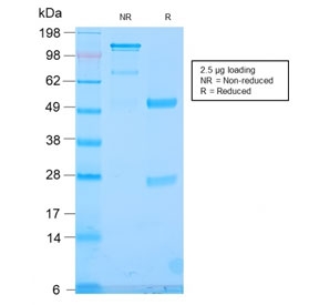 SDS-PAGE analysis of purified, BSA-free recombinant TLE1/Transducin-Like Enhancer Protein 1 antibody (clone TLE1/2946R) as confirmation of integrity and purity.