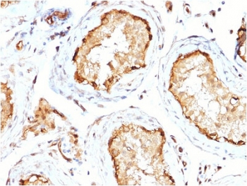 IHC staining of FFPE human testis with 14-3-3 epsilon antibody (clone CPTC-YWHAE-1). HIER: boil tissue sections in pH6, 10mM citrate buffer, for 10-20 min followed by cooling at RT for 20 min.