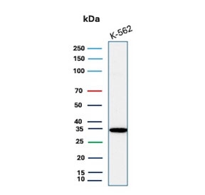 Western blot testing of human K562 cell lysate with CA8 antibody. 