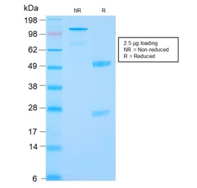 SDS-PAGE analysis of purified, BSA-free recombinant Carbonic Anhydrase 9 antibody (clone CA9/2993R) as confirmation of integrity and purity.