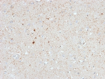 IHC testing of FFPE human cerebellum with Calretinin antibody (clone CALB2/2603). HIER: boil tissue sections in pH 9 10mM Tris with 1mM EDTA for 10-20 min followed by cooling at RT for 20 min.