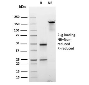 SDS-PAGE analysis of purified, BSA-free Cyclin D2 antibody (clone CCND2/2620) as confirmation of integrity and purity.