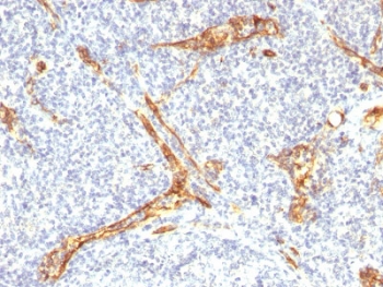 CD34 Antibody Tonsil IHC. Immunohistochemistry testing of FFPE human tonsil with recombinant CD34 antibody (clone HPCA1/2598R). Required HIER: boil tissue sections in 10mM Tris with 1mM EDTA, pH 9, for 10-20 min followed by cooling at RT for 20 min.