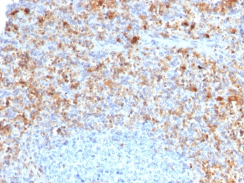 IHC testing of FFPE human spleen with CD40 Ligand antibody (clone CD40LG/2761). HIER: boil tissue sections in pH6, 10mM citrate buffer, for 10-20 min followed by cooling at RT for 20 min.