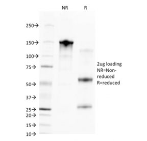 SDS-PAGE analysis of purified, BSA-free CD68 antibody (clone C68/2709) as confirmation of integrity and purity.
