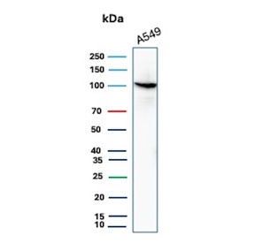 MVP Antibody WB. Western blot analysis of Major Vault Protein (MVP / LRP) expression in human A549 cell lysate using clone VP2897R rabbit monoclonal antibody. A single prominent band is detected at approximately 104-110 kDa, consistent with the predicted molecular weight of Major vault protein. The clean band pattern supports specific detection of MVP as a core structural component of vault complexes, aligning with its role in cytoplasmic ribonucleoprotein assembly and intracellular organization.