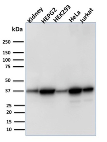 Aldose Reductase Antibody Multi-Sample WB. Western blot analysis of human kidney tissue and human HepG2, HEK293, HeLa, and Jurkat cell lysates using Aldose Reductase Antibody clone CPTC-AKR1B1-3. A predominant band is detected near approximately 35-40 kDa across multiple samples, consistent with the expected molecular weight range of Aldose reductase / AKR1B1, a cytoplasmic aldo-keto reductase family enzyme involved in polyol pathway metabolism, glucose-responsive signaling, and oxidative stress-associated cellular regulatory mechanisms.