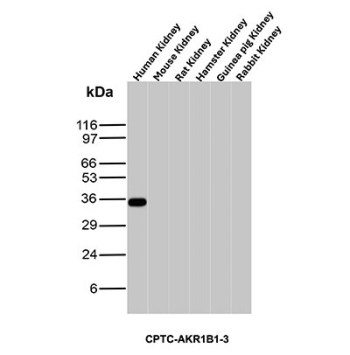 Aldose Reductase Antibody Cross-Species WB. Western blot analysis of human, mouse, rat, hamster, guinea pig, and rabbit kidney tissue lysates using Aldose reductase Antibody clone CPTC-AKR1B1-3. A distinct band is detected near approximately 35-40 kDa in human kidney tissue, consistent with the expected molecular weight range of Aldose reductase / AKR1B1, a polyol pathway-associated metabolic enzyme involved in glucose metabolism and oxidative stress-responsive cellular regulation. Minimal signal is observed in the additional species tested under these experimental conditions.