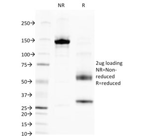 SDS-PAGE analysis of purified, BSA-free ALPL antibody (clone V17.1) as confirmation of integrity and purity.