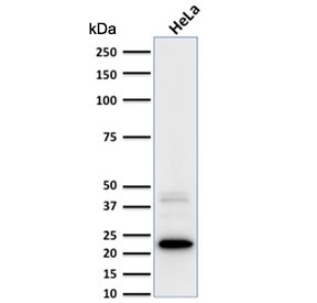 FTL Antibody HeLa WB. Western blot analysis of human HeLa cell lysate using FTL Antibody detects a strong band at approximately 20 kDa, consistent with ferritin light chain / FTL. A weaker higher molecular weight band may represent ferritin complex-associated or partially processed ferritin species. This ferritin complex assembly antibody supports detection of an intracellular ferritin subunit involved in iron sequestration, ferritin nanocage organization, and oxidative stress-responsive cellular regulation pathways.