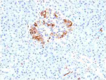 FTL Antibody Pancreas IHC. Immunohistochemistry analysis of FFPE human pancreas tissue stained with FTL Antibody demonstrates strong granular cytoplasmic HRP-DAB brown staining within clustered islet-associated endocrine cell populations, while surrounding exocrine pancreatic tissue shows comparatively lower background reactivity. The staining pattern is consistent with expression of ferritin light chain / FTL in metabolically active pancreatic cellular compartments involved in ferritin complex assembly and intracellular iron sequestration pathways. This ferritin complex assembly antibody highlights ferritin-associated oxidative stress-responsive cellular regulation within pancreatic tissue. HIER: boil tissue sections in pH 9 10mM Tris with 1mM EDTA for 20 min and allow to cool before testing.