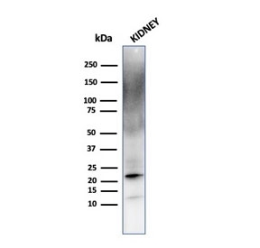 FTL Antibody Kidney WB. Western blot analysis of human kidney tissue lysate using FTL Antibody detects a strong band at approximately 20 kDa, consistent with ferritin light chain / FTL. Additional diffuse higher molecular weight signal may reflect ferritin complex-associated species or partially assembled ferritin protein complexes present in metabolically active renal tissue. This ferritin complex assembly antibody supports detection of intracellular ferritin-associated iron sequestration pathways and oxidative stress-responsive cellular regulation in kidney tissue.