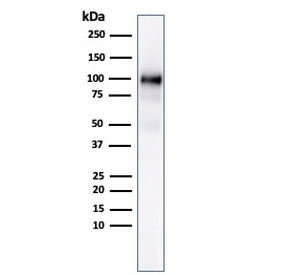 Western blot testing of human pancreas lysate with recombinant rabbit monoclonal GP2 antibody (clone GP2/3134R).