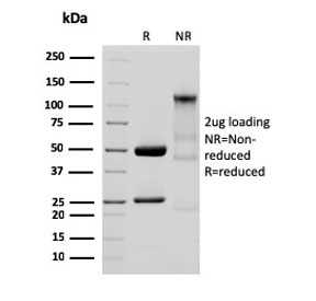 SDS-PAGE analysis of purified, BSA-free recombinant Glycoprotein 2/GP2 antibody (clone GP2/3134R) as confirmation of integrity and purity.