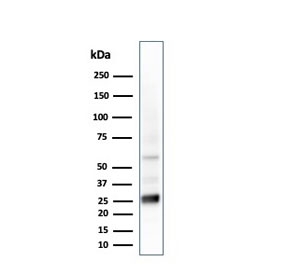 Western blot testing of human liver lysate with GSTM2 antibody (clone CPTC-GSTMu2-2). 