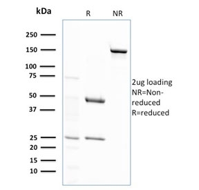 SDS-PAGE analysis of purified, BSA-free GSTM2 antibody (clone CPTC-GSTMu2-2) as confirmation of integrity and purity.