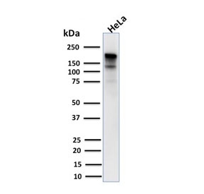 Western blot testing of human HeLa lysate with MSH6 antibody. Expected molecular weight: 120-160 kDa depending on phosphorylation level.