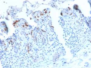 DC-SIGN Antibody C209/2749R in Human Small Intestine IHC. Immunohistochemistry testing of recombinant clone C209/2749R in FFPE human small intestine tissue. HIER was performed by boiling tissue sections in 10 mM Tris with 1 mM EDTA, pH 9, for 10-20 min followed by cooling at RT for 20 min. Distinct immunoreactivity is observed in scattered cells within the intestinal mucosa, while the secondary-only control inset shows minimal background staining.