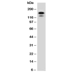 Western blot testing of human HeLa lysate with MSH6 antibody (clone MTS6-1). Expected molecular weight: 120-160 kDa depending on phosphorylation level.