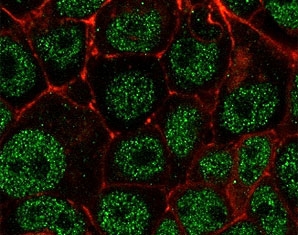 Immunofluorescent staining of permeabilized human MCF7 cells with mouse monoclonal MSH6 antibody (green, clone MTS6-1) and Phalloidin (red).