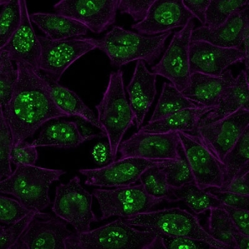 Ki-67 Antibody for IF (clone MKI67/2466) immunofluorescence staining of human HeLa cells. Human HeLa cells were stained with Ki-67 Antibody for IF (clone MKI67/2466). Green fluorescence highlights nuclear Ki-67 / MKI67 expression in proliferating cells, showing the characteristic punctate nuclear staining pattern associated with this cell cycleâregulated proliferation marker. Cell boundaries and actin-rich structures are visualized with Phalloidin (red-purple), allowing clear visualization of cellular morphology and confirming nuclear localization of the Ki-67 signal in actively cycling cells.