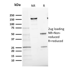 SDS-PAGE analysis of purified, BSA-free Ki-67 Antibody for IF (clone MKI67/2466) as confirmation of integrity and purity.