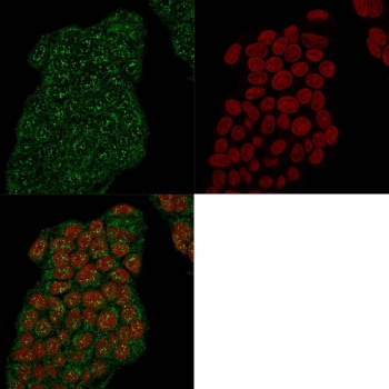 Mammaglobin Antibody for IF immunofluorescence staining of human MCF7 cells. Permeabilized human MCF7 breast carcinoma cells were stained with Mammaglobin Antibody for IF (clone MGB/2682R). Green fluorescence highlights Mammaglobin A / SCGB2A2 expression within the cytoplasm of tumor epithelial cells, consistent with the localization of this secreted breast-associated protein. Nuclei are counterstained with Reddot nuclear stain (red), allowing visualization of cell morphology and confirming cytoplasmic distribution of the Mammaglobin signal in breast cancer cells.