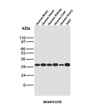 MTAP Antibody Tissue Panel WB. Western blot analysis of MTAP expression in human brain, heart, kidney, liver, ovary, and A431 cell lysates using MTAP antibody clone MTAP/3137R. A band is detected at approximately 30-35 kDa across multiple tissues, reflecting broad expression of MTAP in metabolically active cells.