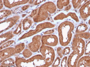 MTAP Antibody Kidney IHC. Immunohistochemical analysis of Methylthioadenosine phosphorylase (MTAP) in formalin-fixed, paraffin-embedded human kidney tissue using MTAP antibody clone MTAP/3137R. Strong cytoplasmic staining is observed in renal tubular epithelial cells, consistent with MTAP expression in metabolically active tissues. HIER: steam sections in pH 9 10 mM Tris with 1 mM EDTA for 20 min followed by cooling prior to staining.