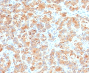 Immunohistochemistry of Glycoprotein 2 Antibody Recombinant Rabbit MAb in human pancreas. Formalin-fixed, paraffin-embedded human pancreas tissue was stained using Glycoprotein 2 Antibody Recombinant Rabbit MAb PSGMG2-2R. Heat-induced epitope retrieval was performed by boiling tissue sections in pH 9 10mM Tris with 1mM EDTA. HRP-DAB brown staining highlights pancreatic acinar cells with strong cytoplasmic and apical localization, consistent with the known distribution of Glycoprotein 2 within zymogen granules of exocrine pancreatic cells. Surrounding stromal tissue and pancreatic ductal structures show minimal staining.