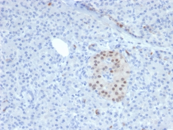 IHC staining of FFPE human pancreas with NKX6.1 antibody. HIER: boil tissue sections in pH6, 10mM citrate buffer, for 10-20 min and allow to cool before testing.