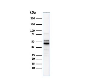 Western blot testing of human PC-3 cell lysate with recombinant ODC1 antibody. Predicted molecular weight ~51 kDa.