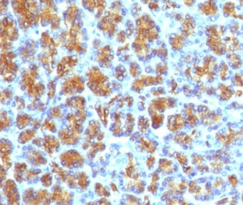 Immunohistochemistry of CELA3B Antibody Recombinant Rabbit MAb ELTS3B-4R in human pancreas. Formalin-fixed, paraffin-embedded human pancreatic tissue demonstrates strong granular cytoplasmic staining in acinar cells, consistent with the secretory localization of Chymotrypsin-like elastase family member 3B, while surrounding stromal elements are largely negative. Required HIER: boil tissue sections in 10mM Tris with 1mM EDTA, pH 9, for 10-20 min followed by cooling at RT for 20 min.