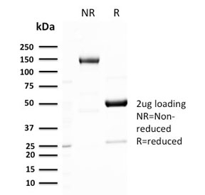 SDS-PAGE analysis of purified, BSA-free recombinant GLUT1 antibody GLUT1/3132R as confirmation of integrity and purity.