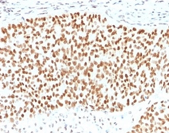 IHC staining of FFPE human pancreas with SOX9/Transcription factor SOX-9 antibody. HIER: boil tissue sections in pH 9 10mM Tris with 1mM EDTA for 10-20 min followed by cooling at RT for 20 min.