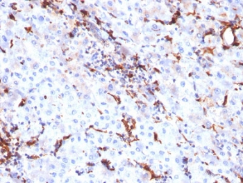 Cathepsin K Lysosomal Protease Antibody Liver Tissue IHC. Immunohistochemistry analysis of FFPE human liver tissue using Cathepsin K Antibody (clone CTSK/2791) shows focal granular cytoplasmic staining in scattered cells, consistent with CTSK / Cathepsin K localization in lysosomal compartments. The punctate staining pattern reflects lysosomal protease distribution associated with tissue remodeling activity, while hepatocytes show comparatively low background staining. Hematoxylin counterstain provides nuclear contrast and structural context. HIER: boil FFPE tissue sections in pH 6, 10 mM citrate buffer, for 10-20 min followed by cooling at RT for 20 min.