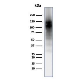 CD56 Antibody for WB (clone 56C04/123A8). Western blot analysis of human brain tissue lysate demonstrates a strong band cluster between approximately 120-180 kDa corresponding to Neural cell adhesion molecule 1 (NCAM1), also known as CD56. These bands represent the major transmembrane NCAM1 isoforms commonly observed in neural tissues. Additional signal near approximately 110 kDa may correspond to a soluble or processed NCAM fragment. The broad band pattern is consistent with the heavily glycosylated nature of NCAM proteins and the presence of multiple splice variants expressed in brain tissue.