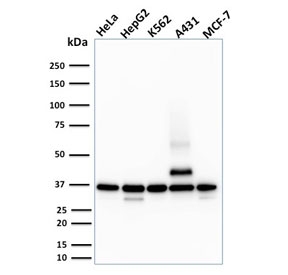 RAD51 Antibody Human Cell Lines WB. Western blot analysis of RAD51 expression using a RAD51 antibody. Lane 1: human HeLa cell lysate. Lane 2: human HepG2 cell lysate. Lane 3: human K562 cell lysate. Lane 4: human A431 cell lysate. Lane 5: human MCF-7 cell lysate. RAD51, also known as a Homologous Recombination Protein, is a key mediator of DNA double strand break repair and genome stability. A prominent band is detected at approximately 37 kDa in all cell lines, consistent with the predicted molecular weight of RAD51. Additional lower molecular weight bands are observed in some lysates and may represent degradation products or alternatively processed forms, while a higher molecular weight species is evident in A431 cells and may reflect post translationally modified or multimeric forms of RAD51. These results support the utility of RAD51 Antibody for studies of homologous recombination, DNA damage responses, and cancer biology.