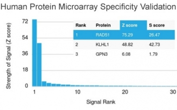 RAD51 Antibody Protein Microarray Validation. Analysis of a HuProt human protein microarray containing more than 19,000 full length human proteins demonstrates the high specificity of the RAD51 antibody clone RAD51/2701. RAD51, also known as RAD51 Recombinase, is a key DNA repair protein involved in homologous recombination and maintenance of genomic stability. Among all proteins represented on the array, RAD51 exhibited the strongest signal with a Z score of 75.29. The next highest signal corresponded to KLHL1 with a Z score of 48.82, yielding an S score of 26.47 for RAD51. The Z score reflects the signal intensity generated by antibody binding relative to the mean signal of all proteins on the array, while the S score measures the difference between the top ranked target and the next highest signal. These results support the high specificity of the RAD51/2701 mAb and validate its utility for studies of DNA damage responses, homologous recombination, and genome maintenance.